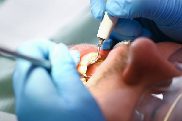 Best Emergency Dental Care for Broken or Chipped Teeth in Kiryas Joel, NY