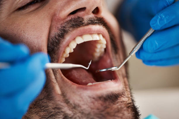 Emergency Dental Care for Adults